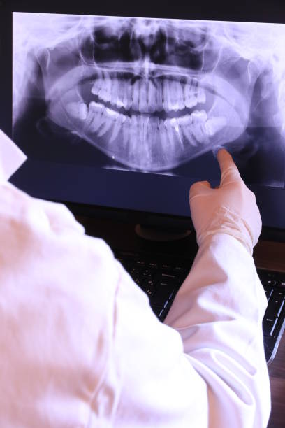 Best Emergency Dentist for Knocked-Out Tooth in Alton, IL